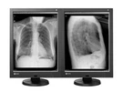 Vidar Advantage Film Digitizer Diagnostic Pro & Eizo Radiforce GX340 Displays. Fixed Price $1999.00.